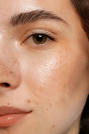 SENSITIVE SKIN - Totoka GmbH